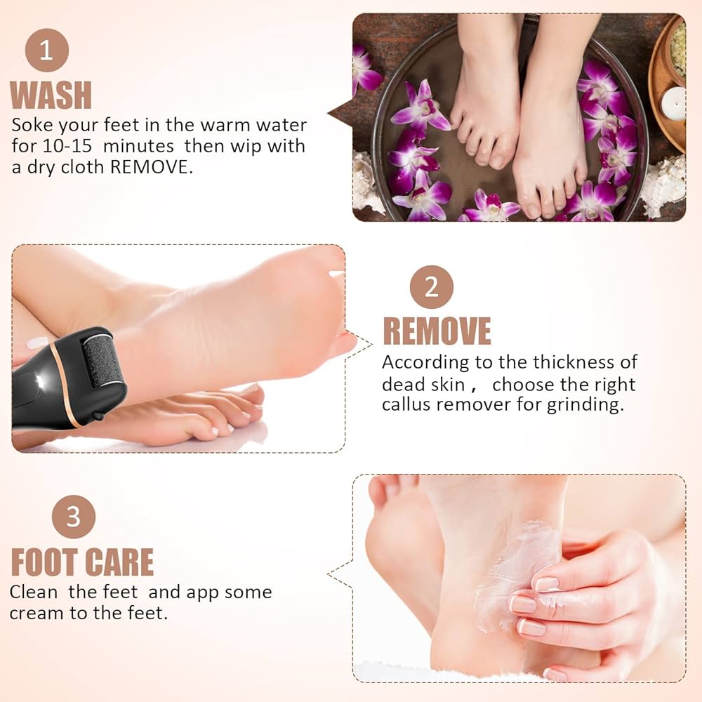 Right Callus Remover