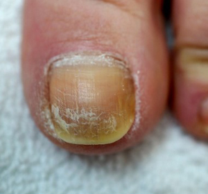 Cuticles Care / Cuticle Management