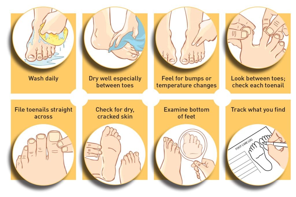 Diabetic Foot Care