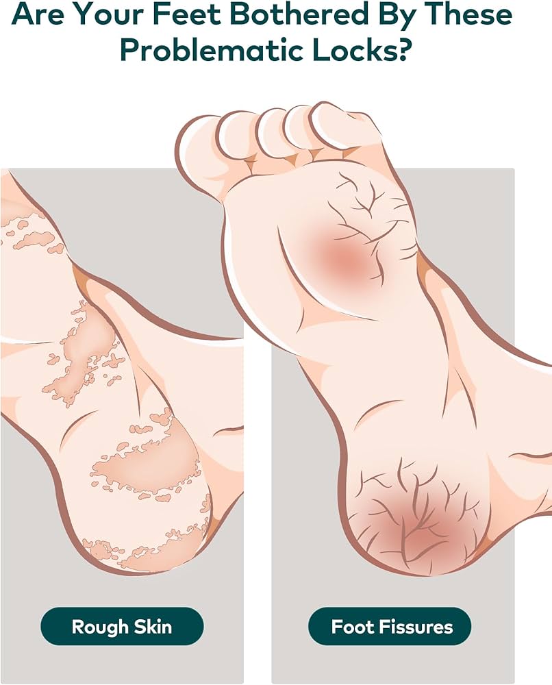 Foot File Common Mistakes