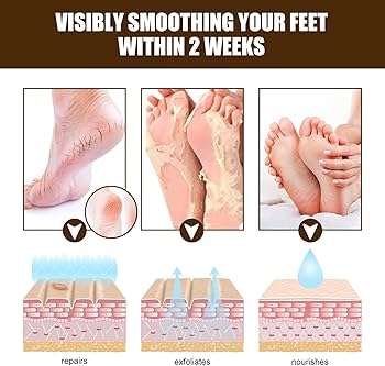 Foot Moisturizer