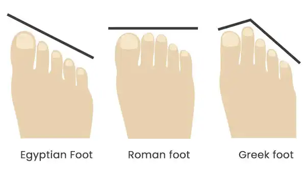 Foot Type