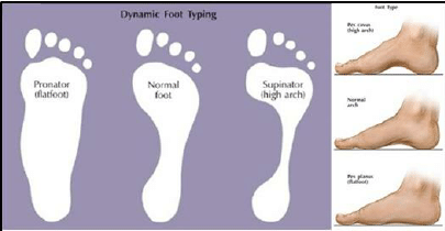 Foot types generally fall into three main categories