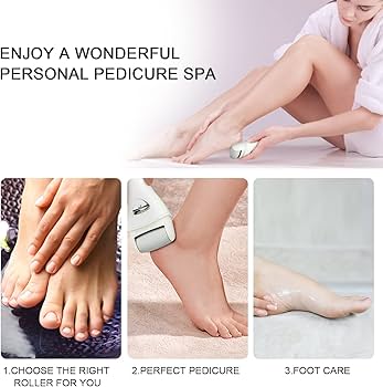 Right Callus Remover