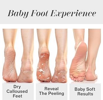 Science of foot Exfoliation