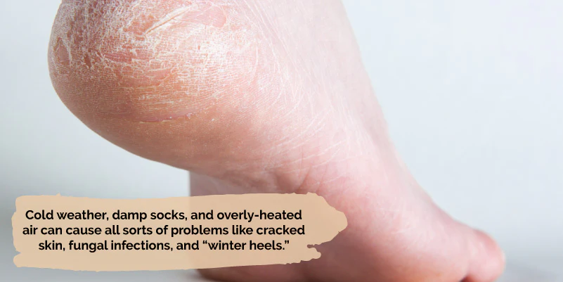 Winter Foot Care