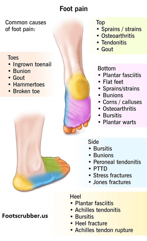 Foot Pain Chart 