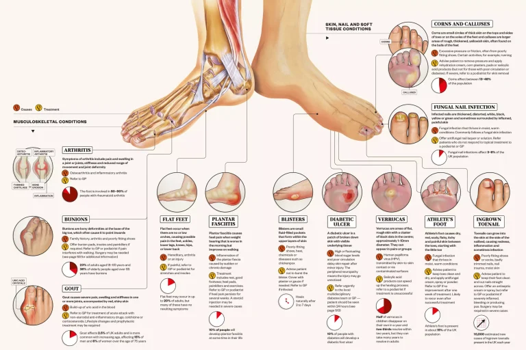 Common Foot Conditions