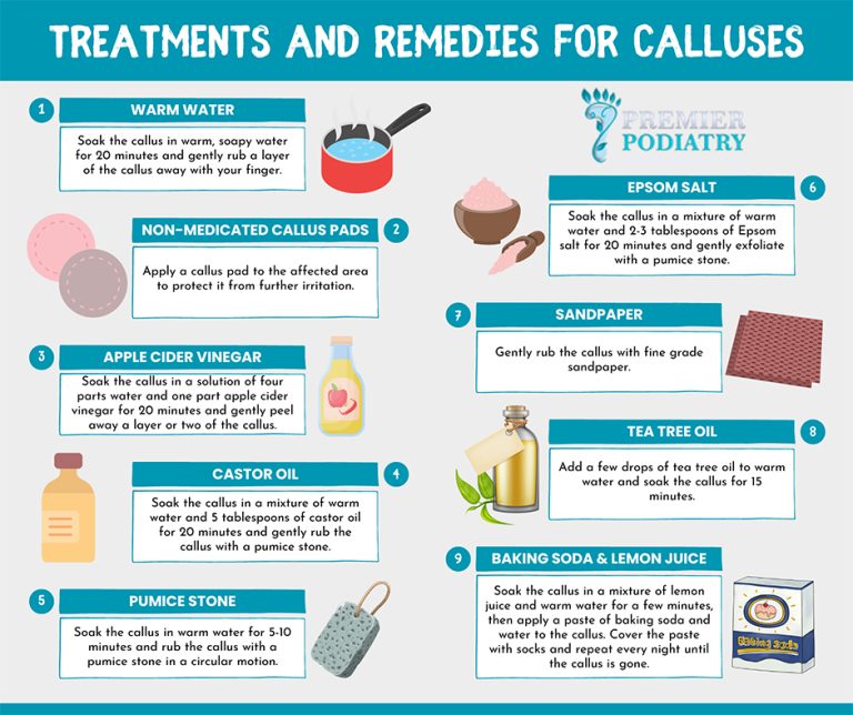 Callus Removal Remedies