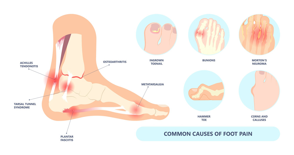 Common Foot Problems and Conditions