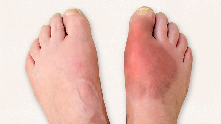 Common Foot Problems and Conditions