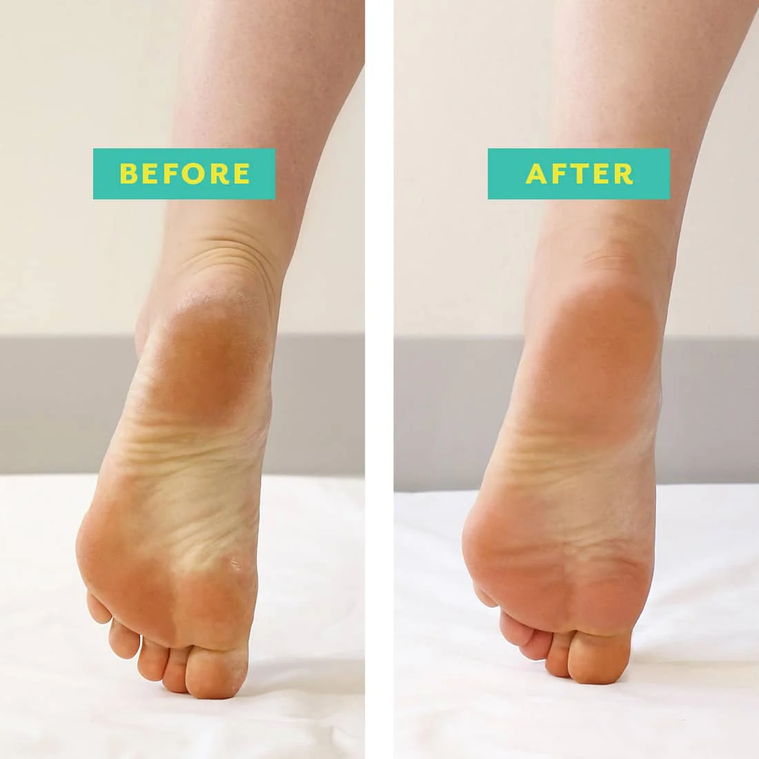 Foot Mask Treatments