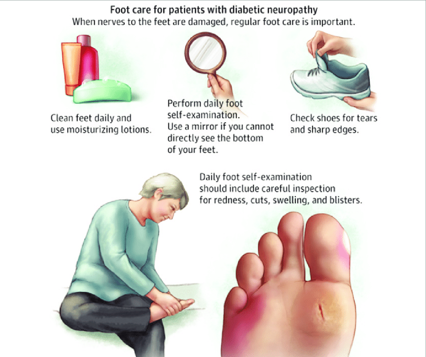 Foot Self-Examinations