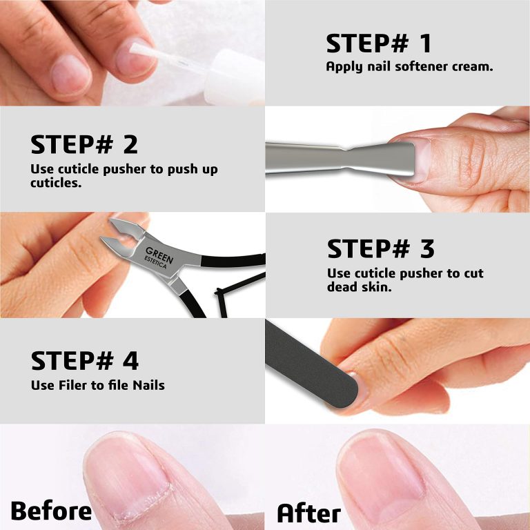 Precision Nail Care