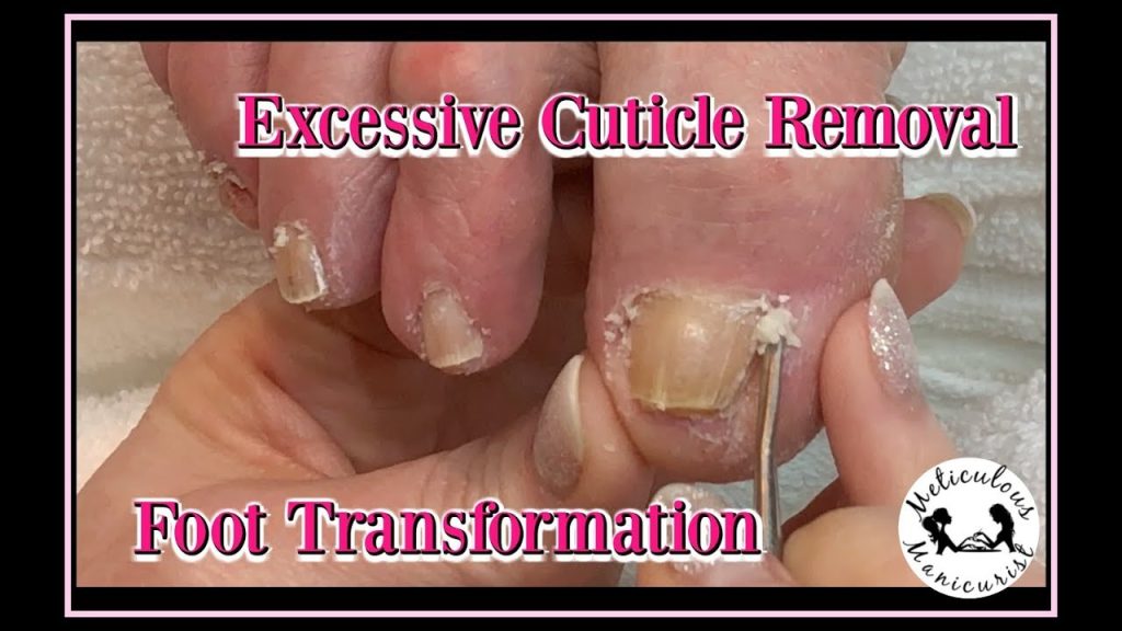 Cuticle Care and Maintenance